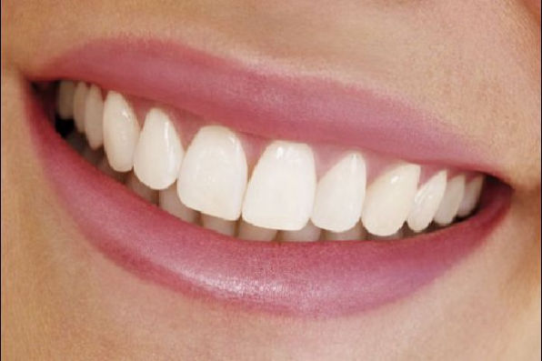 Denture Types